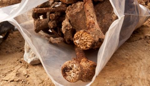 femurs and other bones in a plastic bag