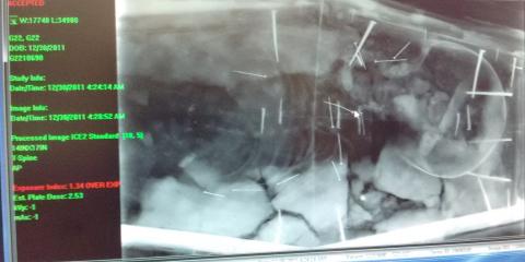 Image of an X-ray on a computer screen