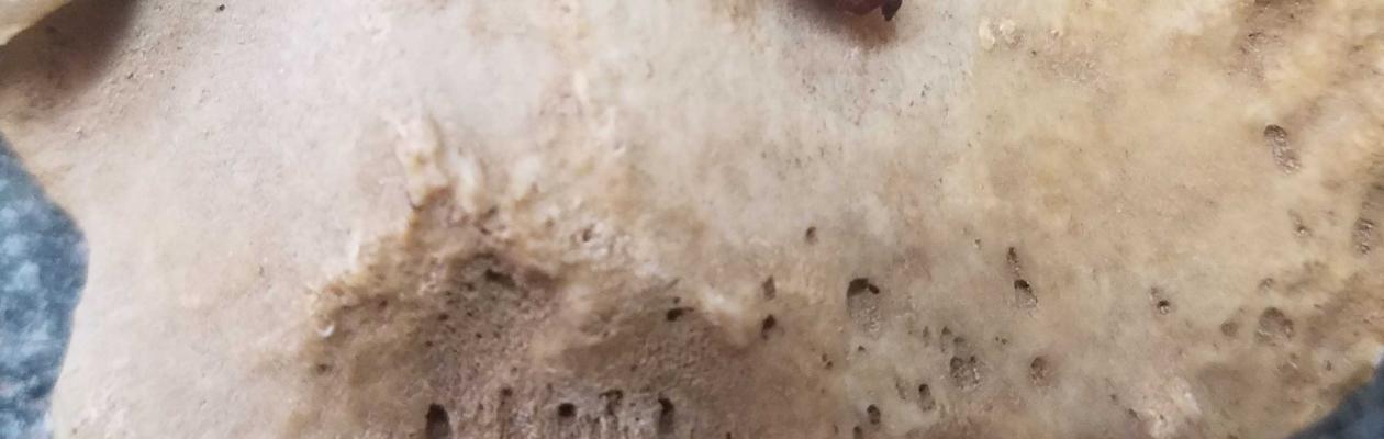 Insect Pupa found on a human bone